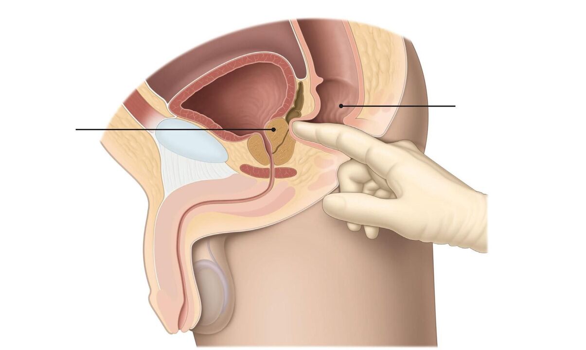 Prostate massage techniques