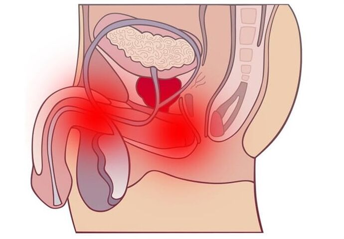 treatment methods for prostatitis
