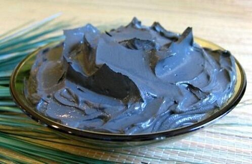 Mud therapy is very beneficial for prostatitis but is not indicated for all patients